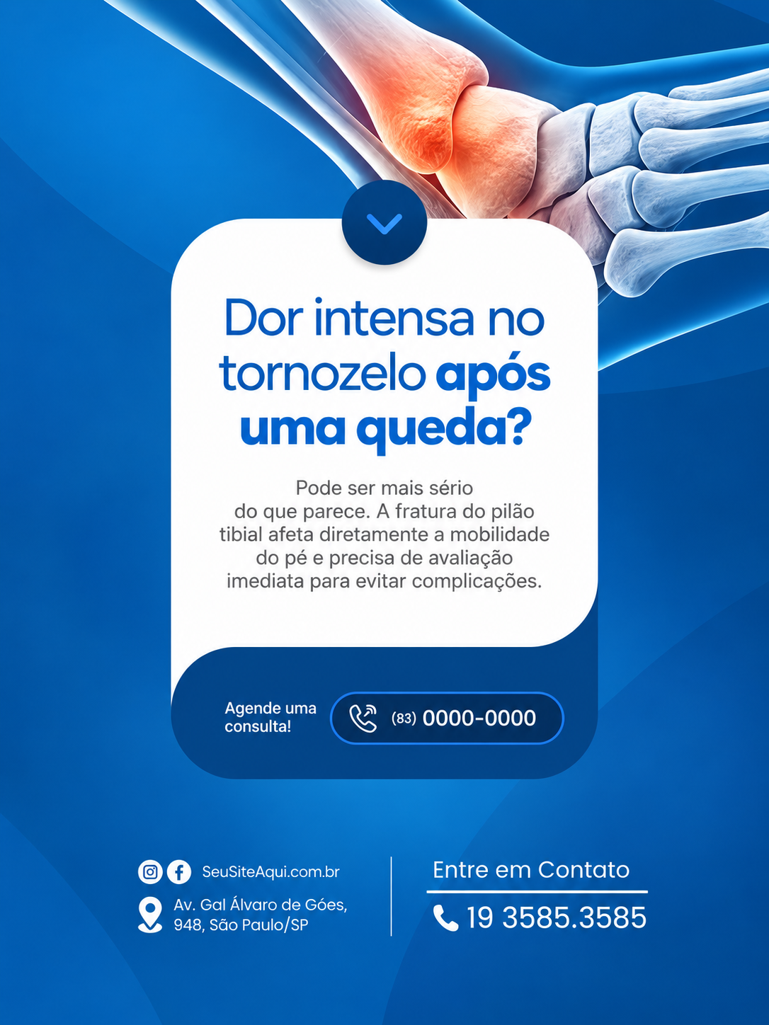 Post 03